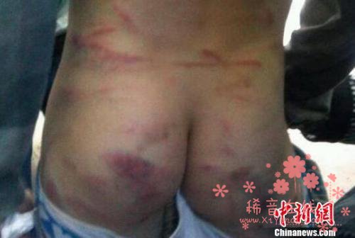 中国首部反家暴法今起实施 “同居暴力”纳入其中