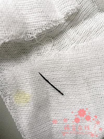 4岁女童心脏附近有根绣花针 取出时已生锈